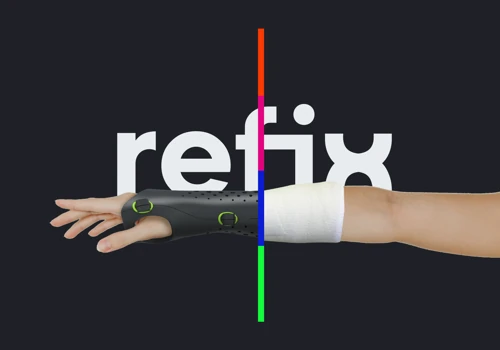 Digital manufacturing applied to orthotic and prosthetic industry.