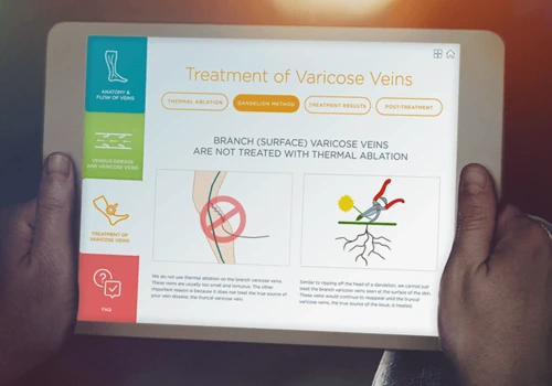 The Ultimate Vein Guide