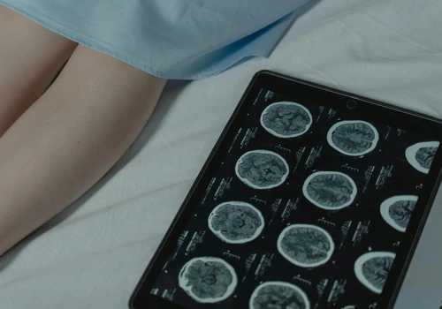AI Solutions for Faster Cancer Diagnostics