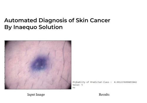 Automated Diagnosis of Skin Cancer