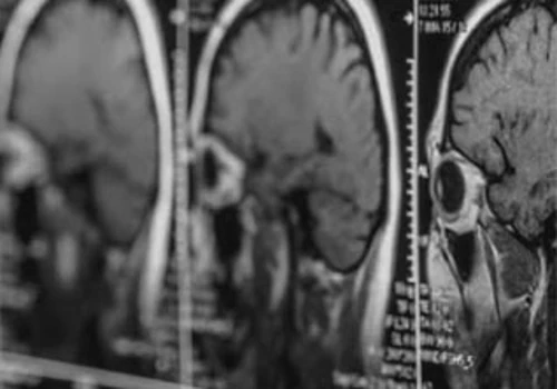 DL in detection of microscopic tissue features