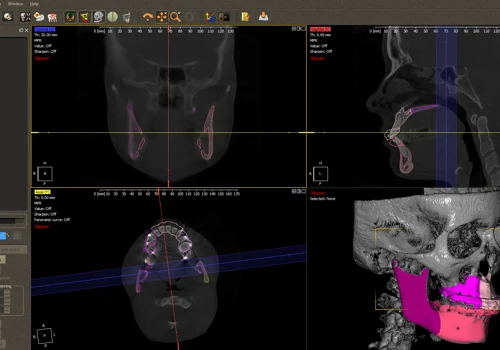 Surgery software