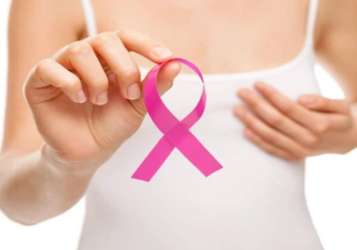 Breast Cancer Guide