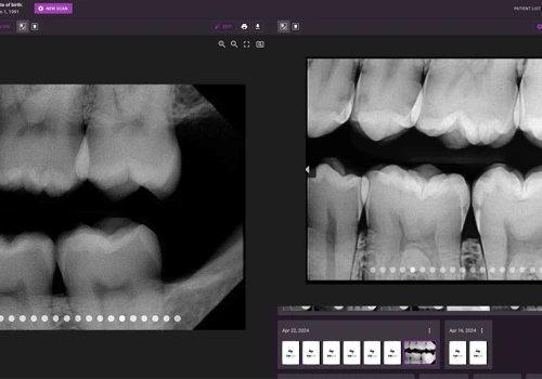 Grayscale: Web-Based X-Ray Imaging Software