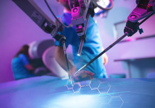 AI project with Smith and Nephew