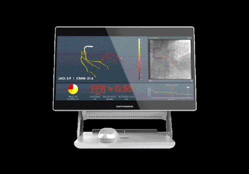 Coronary FFR Computation from X-Ray Angiography