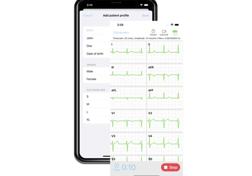 SmartMedicsECG