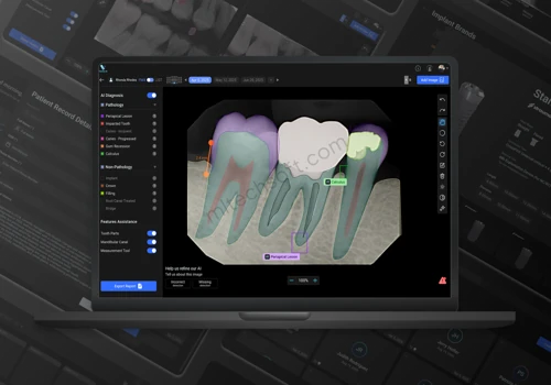 AI-Powered Dental Diagnosis System