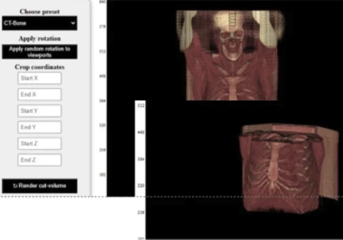 ROI-Based Volume Editing with Cornerstone3D
