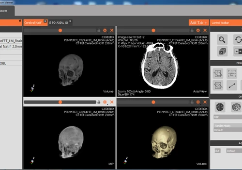 C++/Qt DICOM Viewer