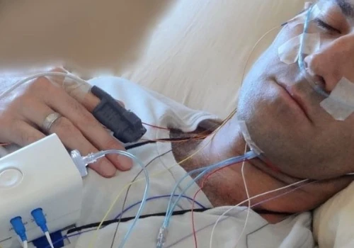 Sleep Study Labs Billing