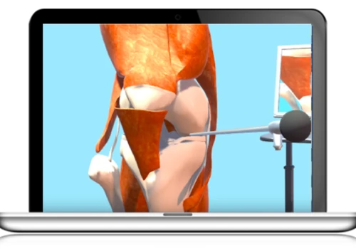 Knee Laparoscopy - Virtual Reality