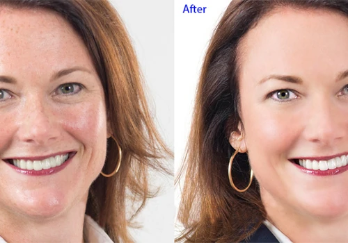 Photo Retouching
