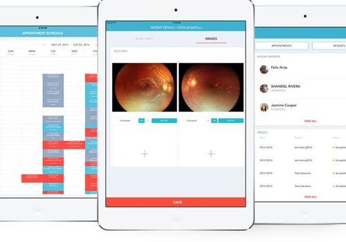 My Retina Dcos