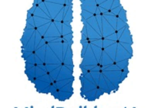 CSD