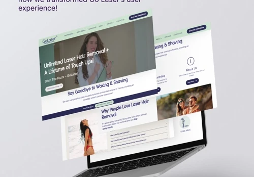 Go Laser Website