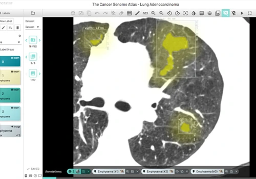 Artificial-Intelligence Diagnostic