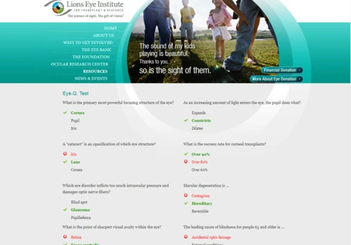 Lions Eye Institute