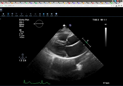 Medical Imaging Viewer