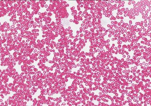 Medical Image Annotation & Data Labeling