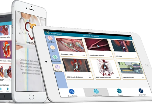 CardioVisual Mobile App